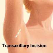 Breast augmentation transaxillary incision location