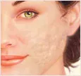 Face with discoloration, surface irregularities
