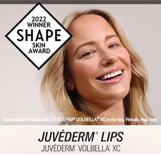 Juvederm Volbella lips, 2022 Shape Award